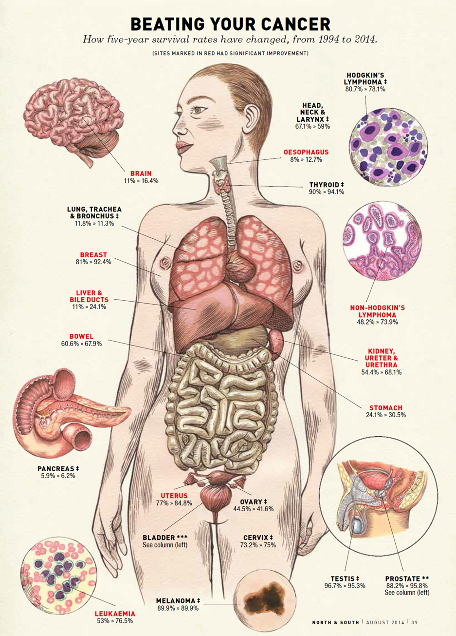 Body diagram cancers