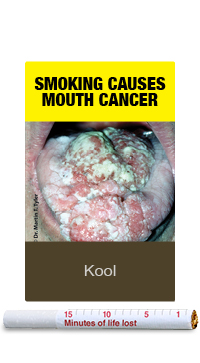 mouth cancer