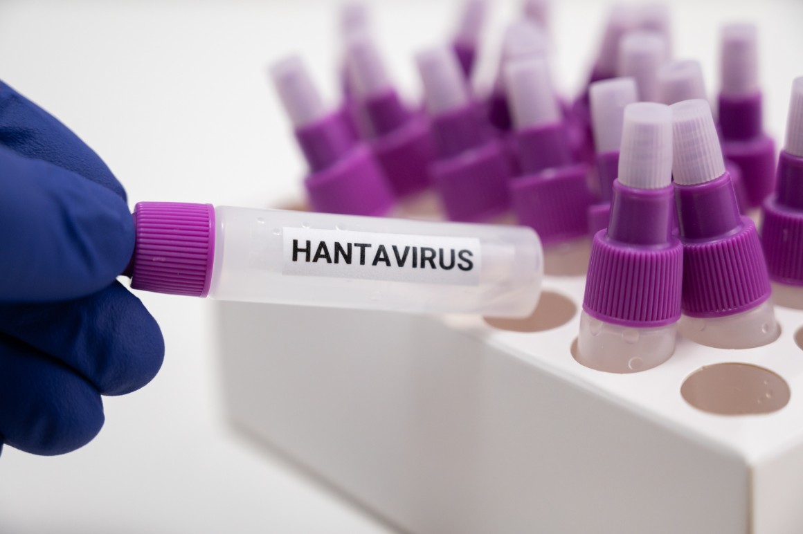 surgical gloved hand with test tube named hantavirus