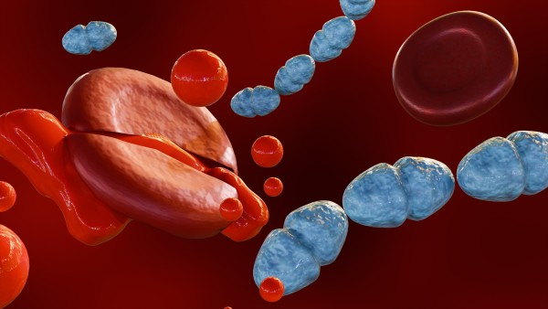 3D rendering of septicemia 